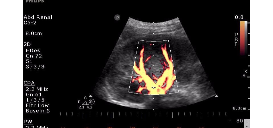 Philips ClearVue 350