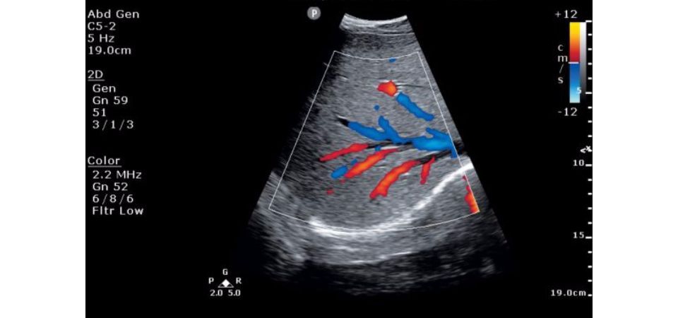 Philips ClearVue 850