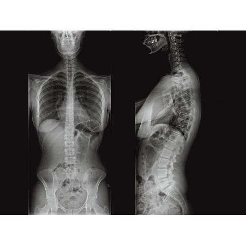 Рентген аппарат GE Optima XR 646