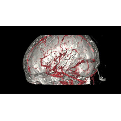 КТ аппарат GE Revolution CT